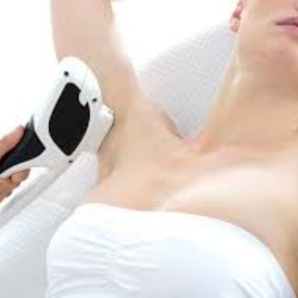 IPL Laser Hair Removal